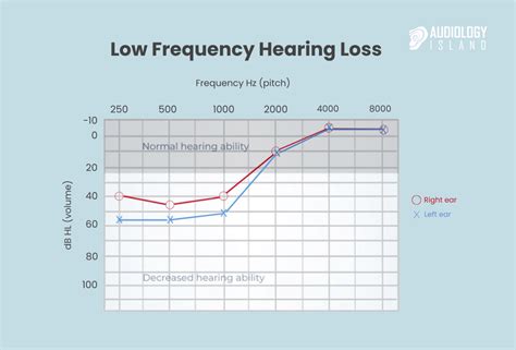 low frequency hearing loss chart